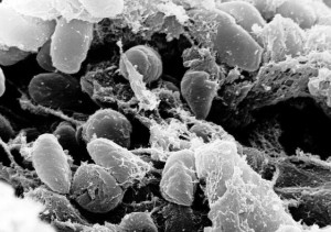 A view of the bubonic plague through an electron microscope. Photo credit / Pixabay